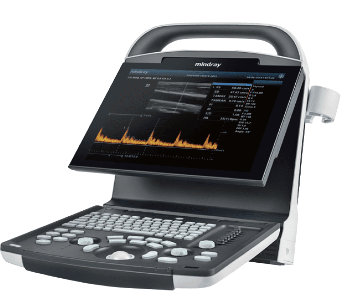Mindray DP-10 Portable Ultrasound System