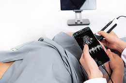 Portable Ultrasound Machine-SonoEye thumbnail 3