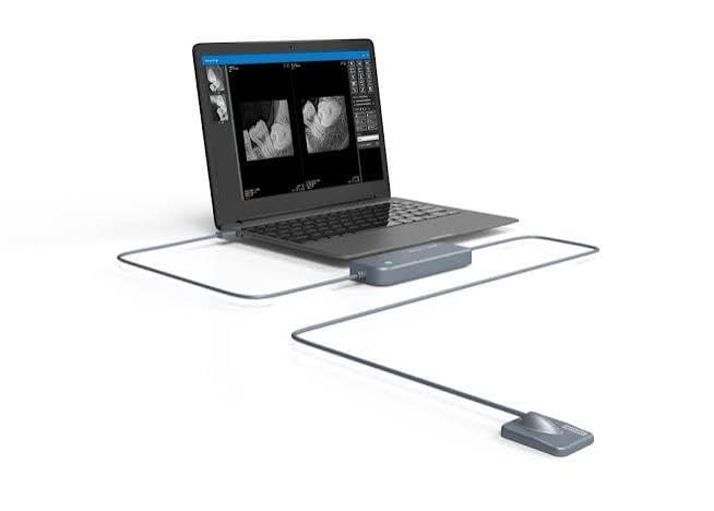 Xpectvision Photon-Counting Intraoral Dental X-Ray Sensor – Size 1