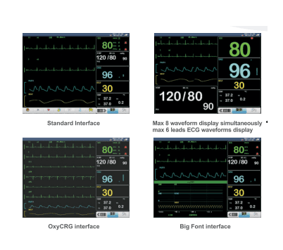 جهاز مراقبة المرضى متعدد المعايير AV-PRO XL مقاس 15 بوصة - حل متطور لمراقبة ICU / CCU thumbnail 2