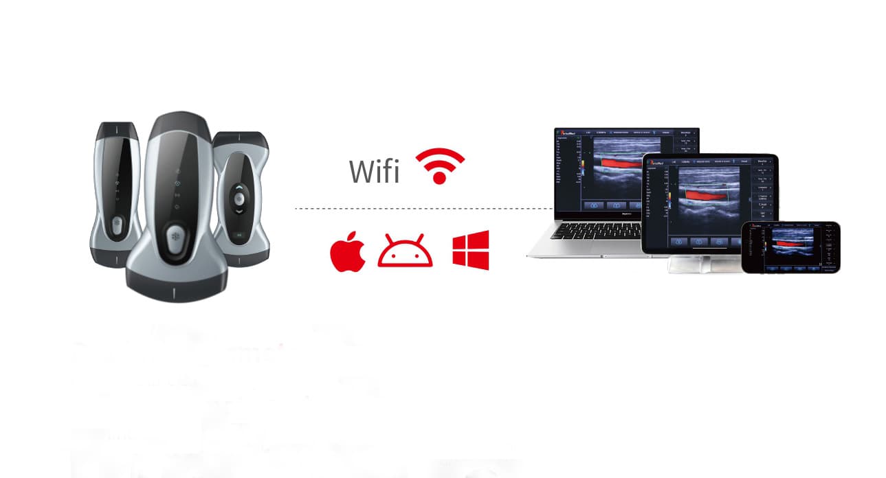 Wireless Ultrasound Machine thumbnail 3