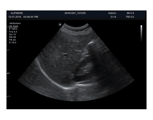 Portable Ultrasound Machine thumbnail 2