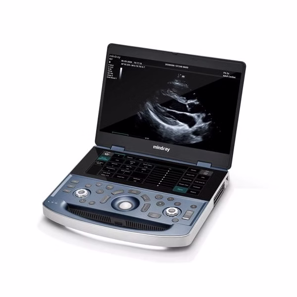 Mindray Portable Ultrasound System MX7