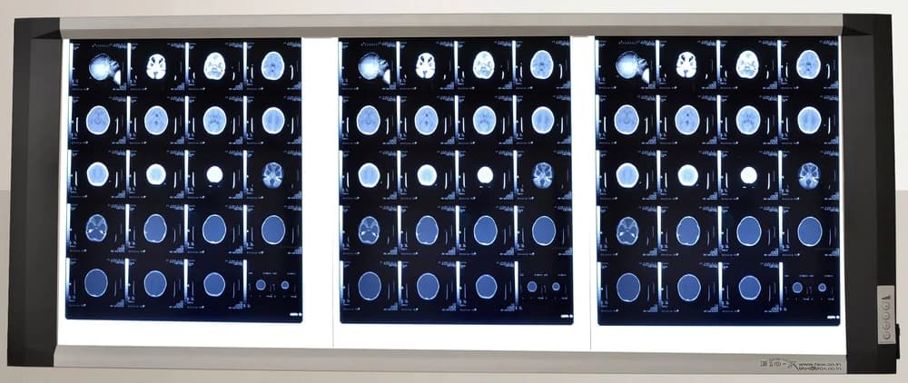 Triple Panel X-Ray Film Viewer