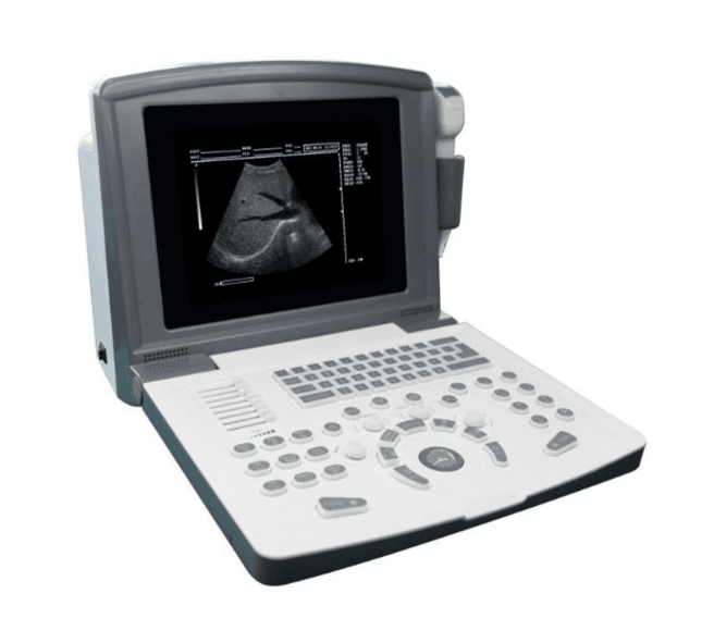 Portable Ultrasound Machine