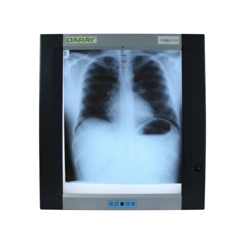 X-Ray Film Viewer