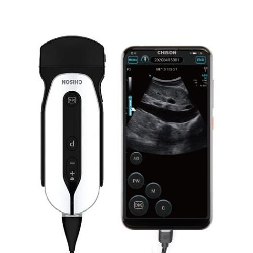 Portable Ultrasound Machine-SonoEye