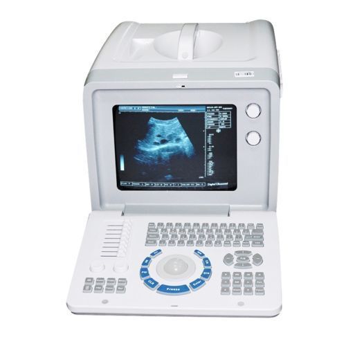 Ultrasound Machine with TV Probe & Convex Probe