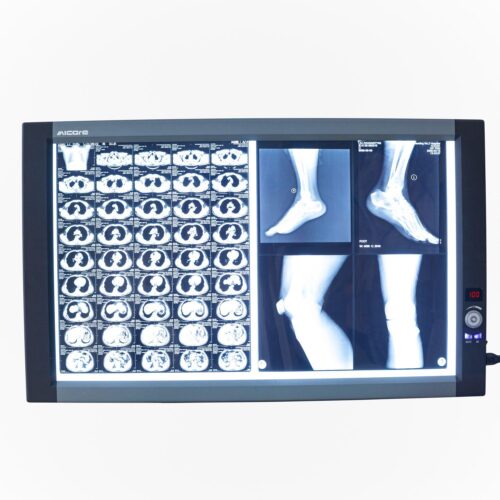 Double Panel X-Ray Film Viewer