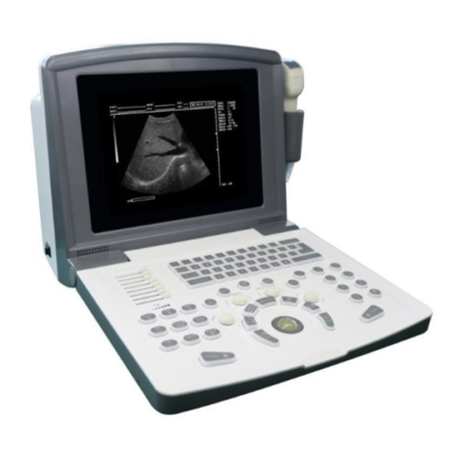 Portable Ultrasound Machine